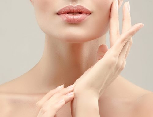 Soothing solutions after a chemical peel
